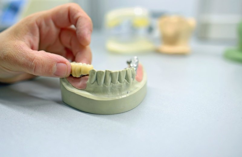 dr. martin with dental bridge