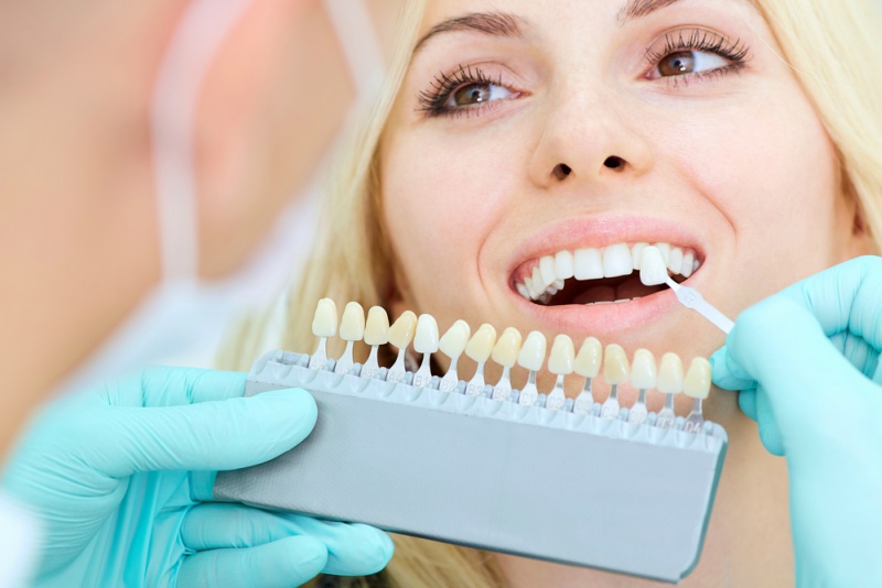 dental veneers in lafayette colorado